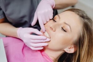 Smile Upgrade Plan in Plantation: Timeline and Costs From Cleaning to Veneers